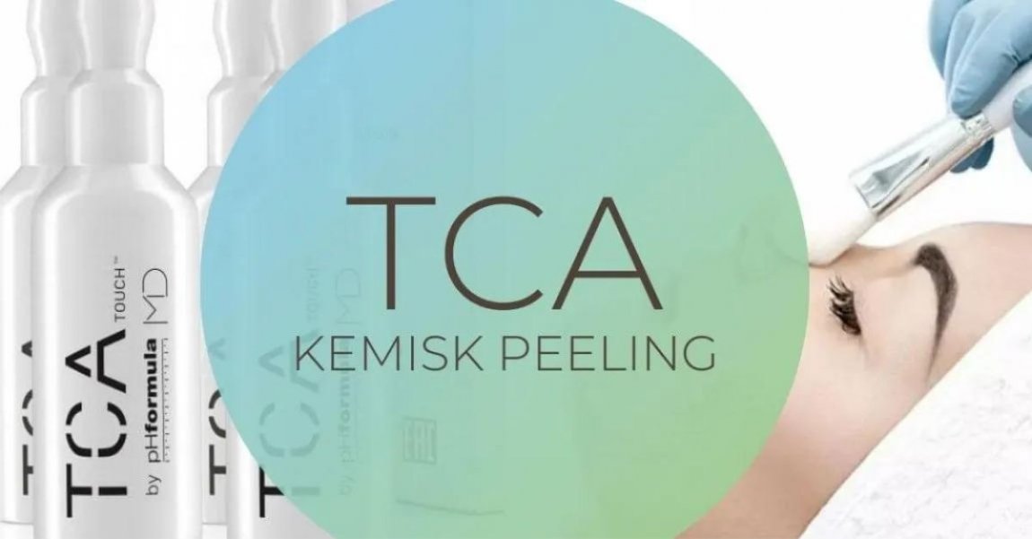 TCA kemisk peeling image 2